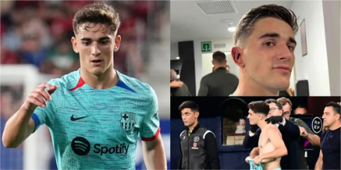 З'явилися фото таланта "Барселони" Гаві після гри зі скрепками у вусі